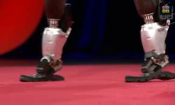 Хью Герр — Бионические протезы позволяют бегать, покорять вершины гор и танцевать